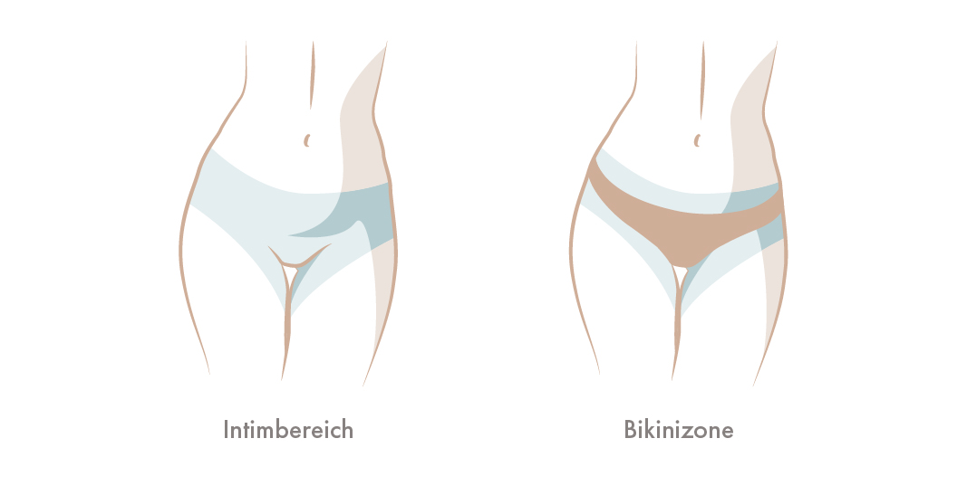 Grafik Bikinizone vs. Intimbereich